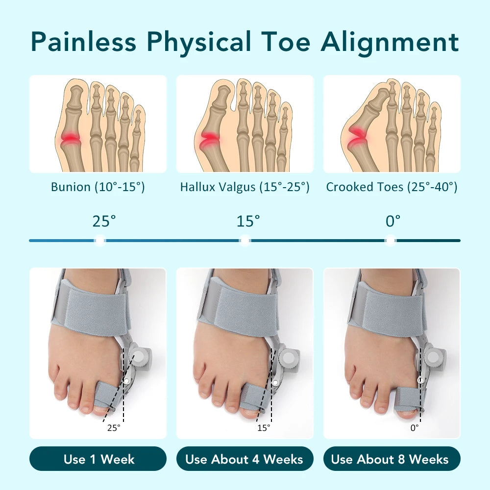Adjustable Bunion Corrector - Hallux Valgus Big Toe Straightener for Day & Night Pain Relief