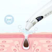 ClearPore™ Visual Blackhead Vacuum Extractor