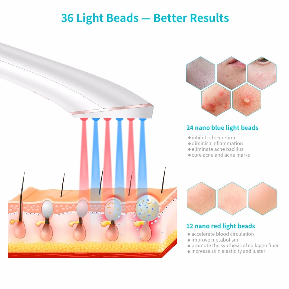 ClearBeam™ Wireless Acne Light Therapy Device