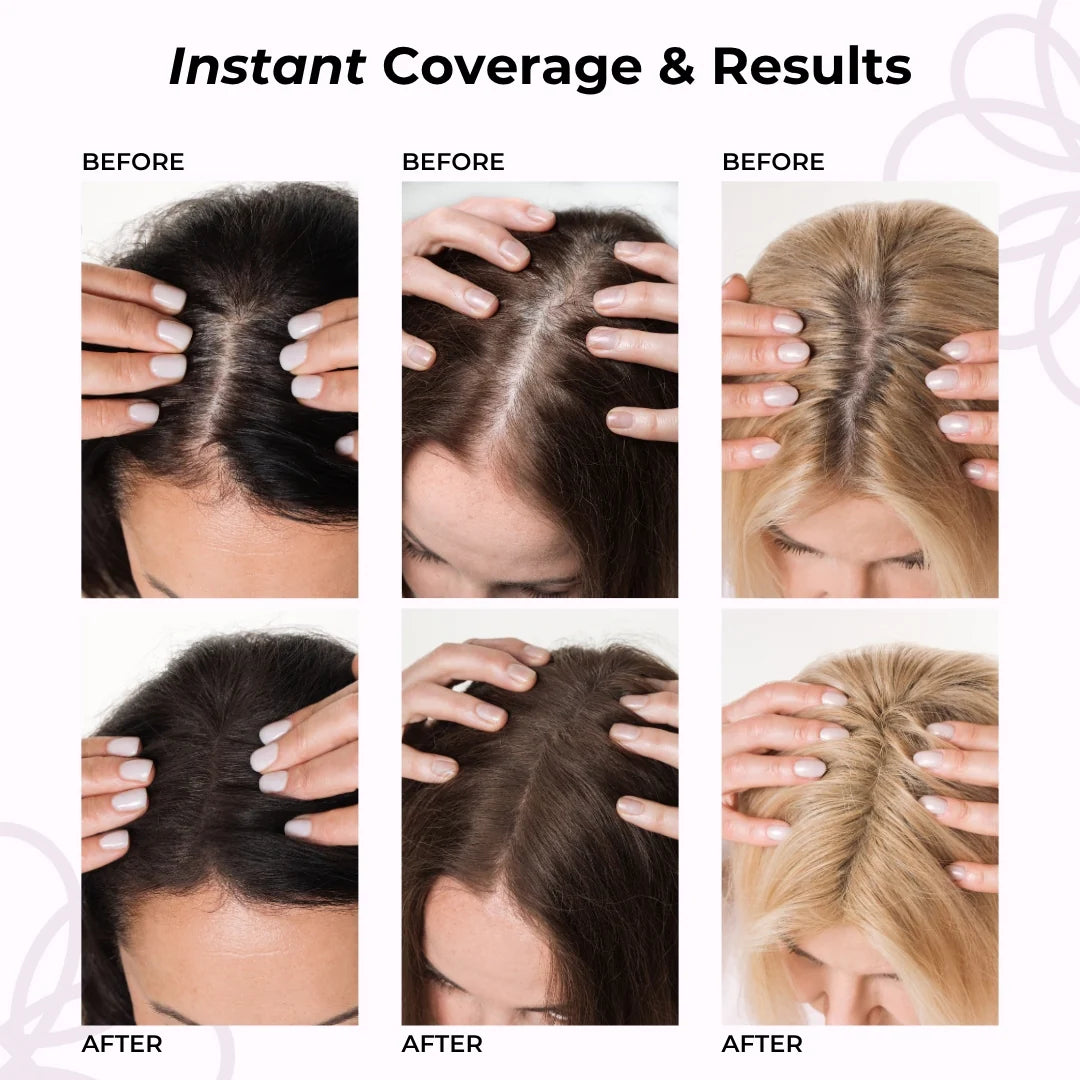 Before and after coverage — comfortable for sensitive scalp