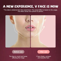 VForm™ EMS LED Photon Face Massager