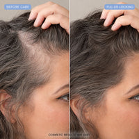 ENIGMAE Scalp Applicator — 8fba1e74-a8ef-4bdd-b8f5-520aeb8b9998