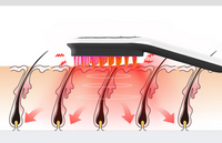 Follicure™ Red-Blue Light Hair Growth Comb