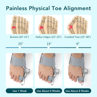 Adjustable Bunion Corrector - Hallux Valgus Big Toe Straightener for Day & Night Pain Relief