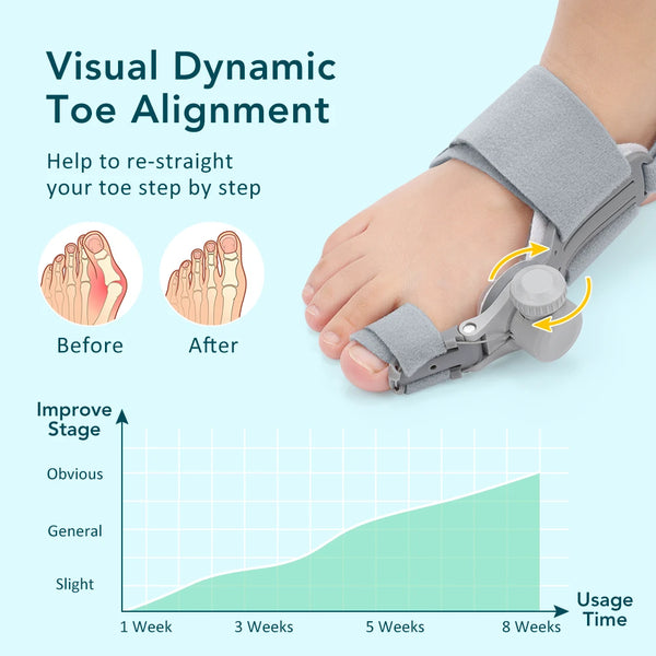 Adjustable Bunion Corrector - Hallux Valgus Big Toe Straightener for Day & Night Pain Relief