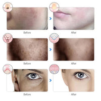 PhotonAura™ 7-Color LED Face & Neck Mask